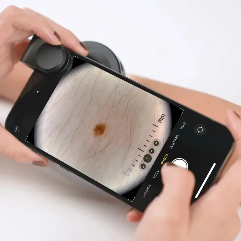 Дерматоскоп для телефону INVITA D-40 Дніпро - фото 5