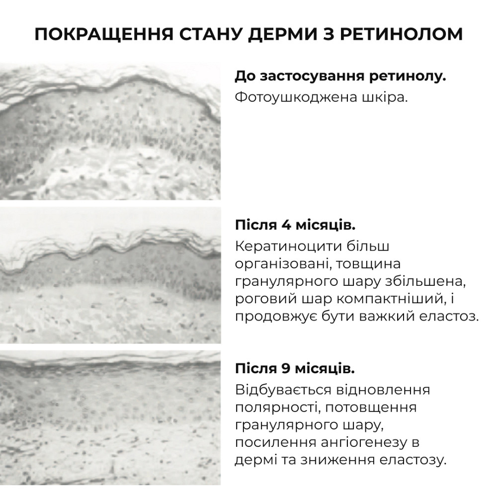 Комплекс глибокого нічного відновлення шкіри ReNuAge Retinol & Collagen Night Ritual Hillary Київ - фото 20