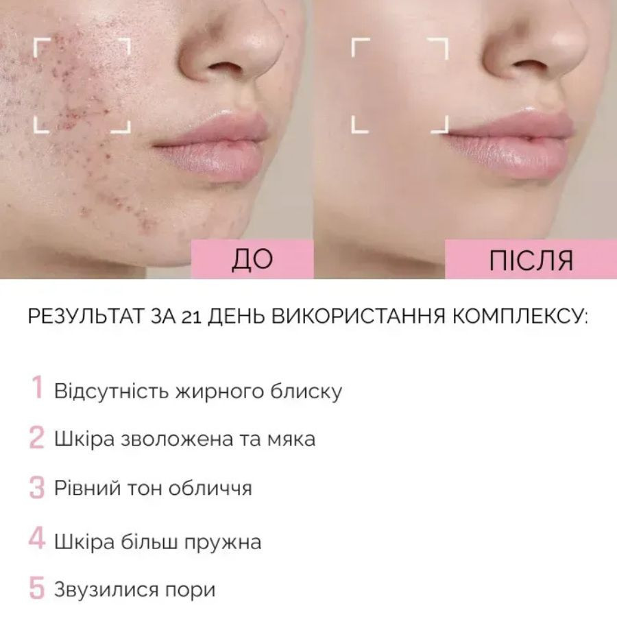Нежная пенка для умывания с ниацинамидом Reclaire cosmetics 150 мл Киев - изображение 8