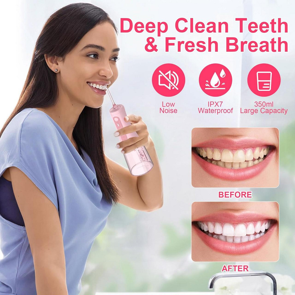 Іригатор Sejoy CYQ-AOW11 Water Flosser Німеччина Дніпро - фото 4