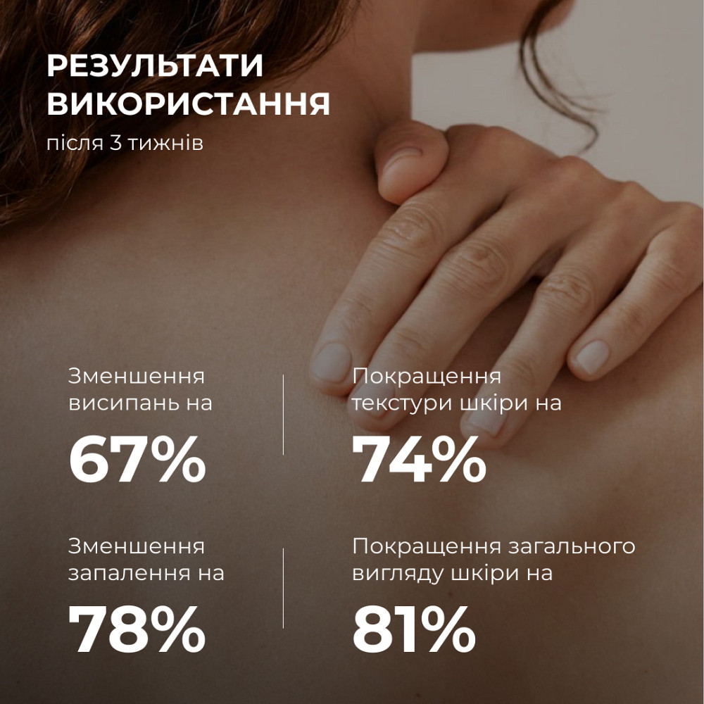 Набір проти запалень і висипань на тілі Back & Body Acne Care Set Hillary Київ - фото 7