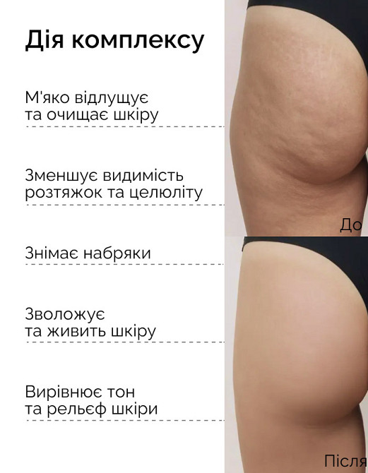 Тройной медовый антицеллюлитный набор SPA Скраб+Обертывания+Крио гель Reclaire cosmetics Киев - изображение 3