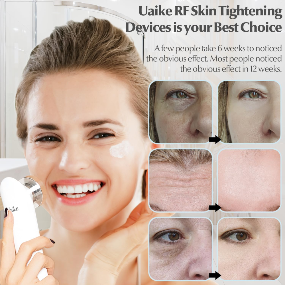 РФ-ліфтинг апарат Uaike RF для підтяжки шкіри обличчя та тіла, радіочастотний пристрій для омолодження, 3 рівні, 2 насадки Київ - фото 10