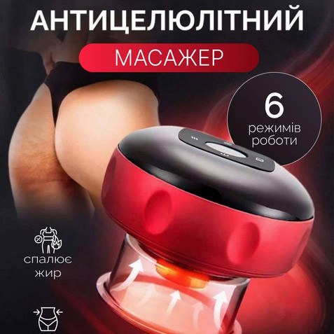 Вакуумный антицеллюлитный массажер с подогревом, массажная антицеллюлитная банка UV-71 Львов - изображение 10