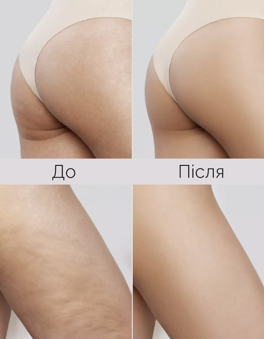 Двухфазный антицеллюлитный концентрат для тела с пептидами и водорослями Reclaire cosmetics 150 мл Киев - изображение 3