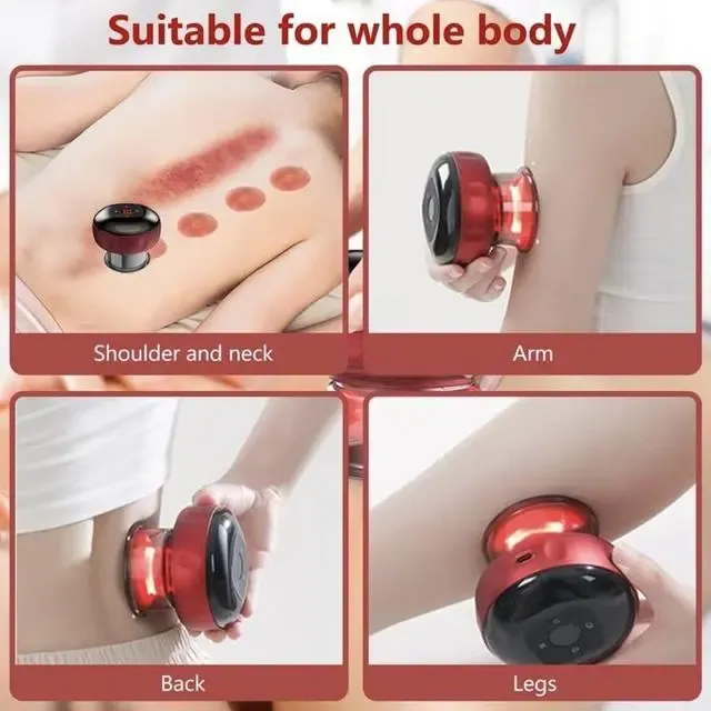 Электрический вакуумный баночный массаж | Массажер для тела | Массажер с эффектом банок Коломыя - изображение 9