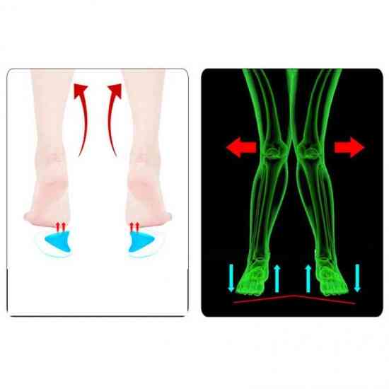 Ортопедичні силіконові вставки для взуття Вінниця