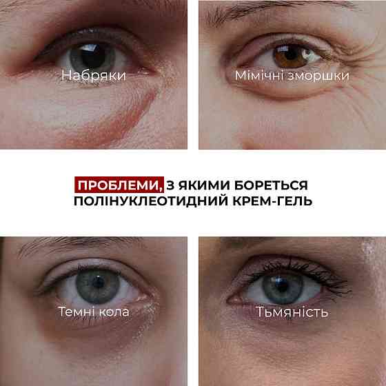 Набор для успокоения кожи и уменьшения признаков усталости вокруг глаз Hillary Soothing Skin & Tired Eye Care Set Киев