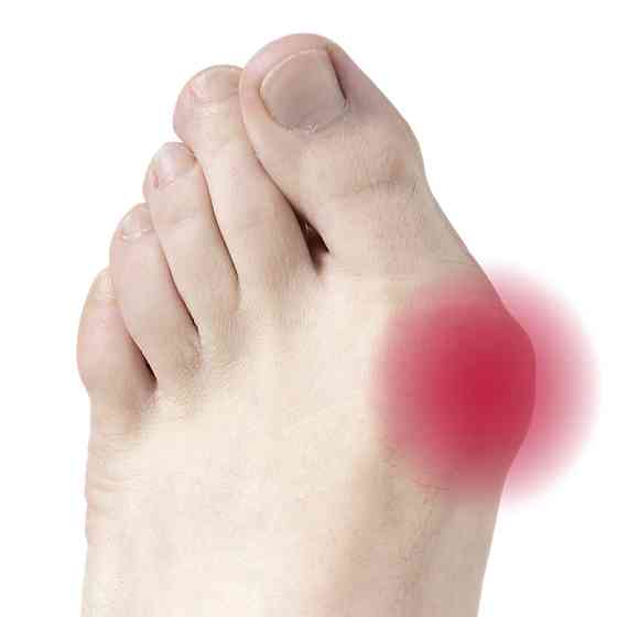Гелевий протектор на великий палець Vitamed 5th Toe Gel Bunion Pad Дніпро