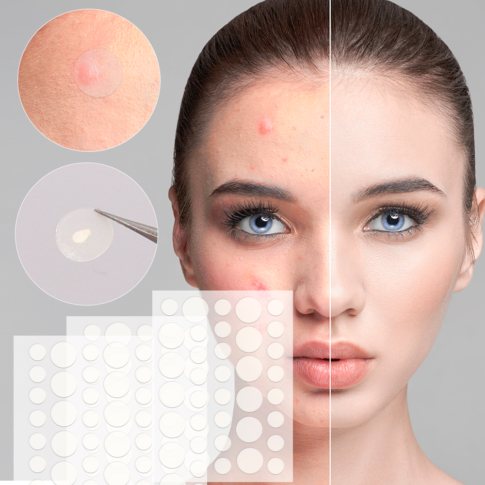 Пластир від прищів та акне 72шт Acne Patch SBR Київ - фото 2