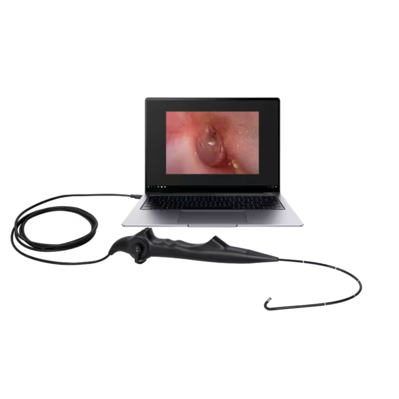 Гнучкий багаторазовий назофарингоскоп BESDATA RL-F2 Дніпро - фото 2