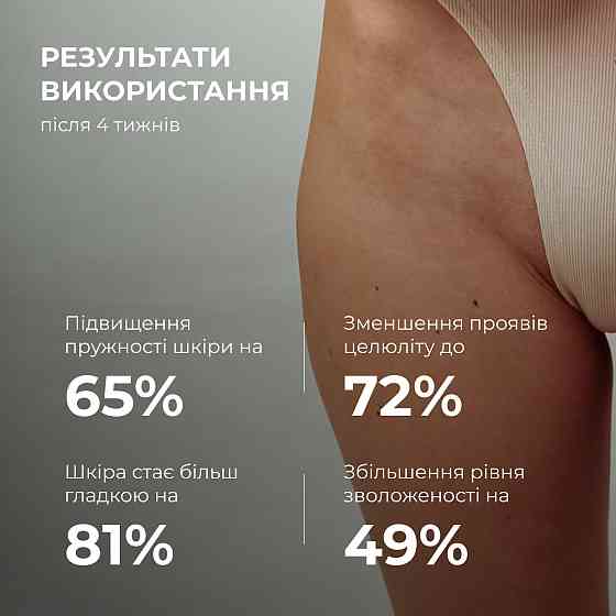 Антицелюлітна суха олія з ксименією Hillary Хimenia Anti-cellulite Dry Body Oil, 250 мл Київ