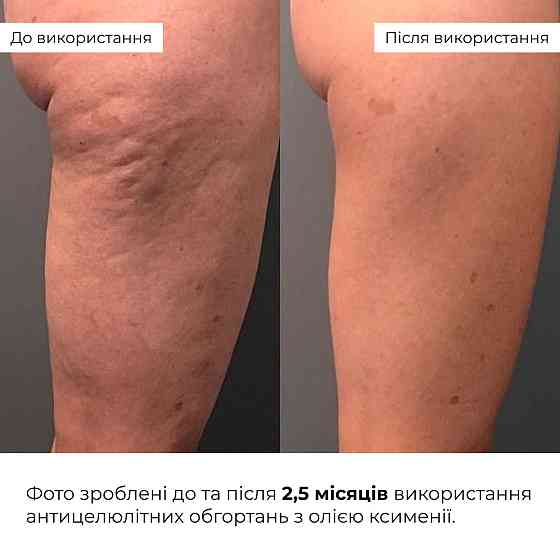 Антицелюлітні обгортання з олією ксименії Hillary Anti-cellulite Bandage African Ximenia Київ