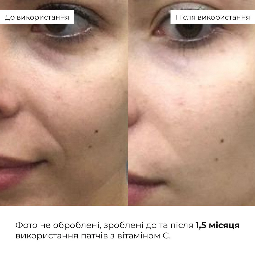 Освежающие укрепляющие патчи с витамином C Hillary Vitamin C Refreshing & Firming Eye Patches, 60 шт Киев - изображение 7