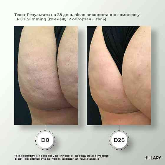 Рідина для антицелюлітних ліпосомальних обгортань Hillary Anti-cellulite Bandage LPD'S Slimming Fluid, 500 мл Київ