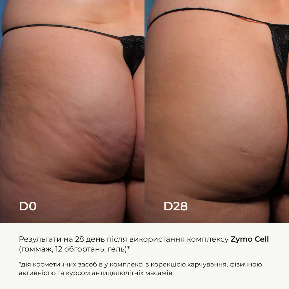 Антицелюлітний ензимний гель Hillary Anti-cellulite Gel Zymo Cell, 200 мл Київ - фото 7