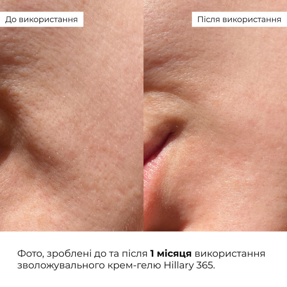 Увлажняющий крем-гель для всех типов кожи Daily Moist 365 Relief Cream Hillary 50 мл Киев - изображение 18