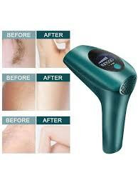 Лазерний епілятор SK-3022 IPL, 5 рівнів енергії, 999999 спалахів, LED дисплей, авто/ручний режим Одеса - фото 2