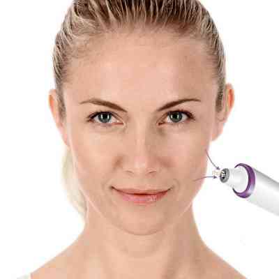 Прибор для чистки кожи лица Beurer FC 76 Винница