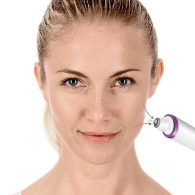 Прилад для чищення шкіри обличчя Beurer FC 76 Вінниця - фото 4