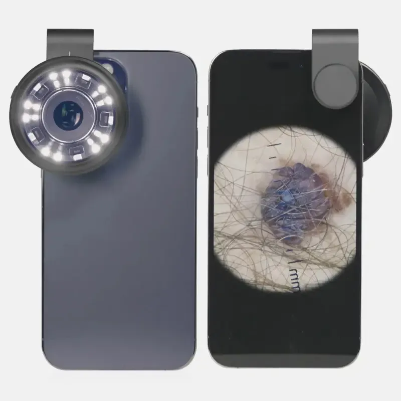 Дерматоскоп для телефону INVITA D-40 Дніпро - фото 3