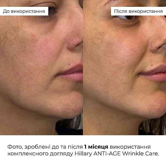 Комплексний догляд Hillary ANTI-AGE Wrinkle Сare Київ