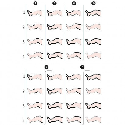 Лімфодренажний апарат 6 камер OSD-FO-3001 Дніпро - фото 4