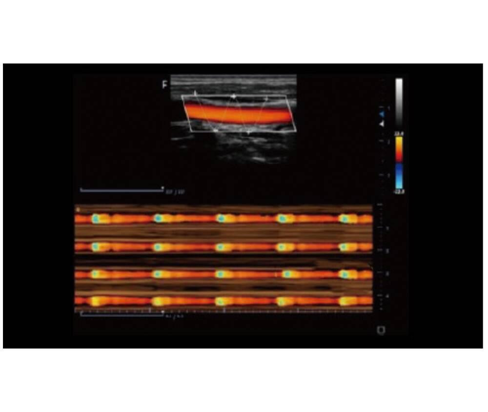 Ультразвукова діагностична система портативна високого класу +2 датчики Finus 50 Focus & Fusion Дніпро - фото 7