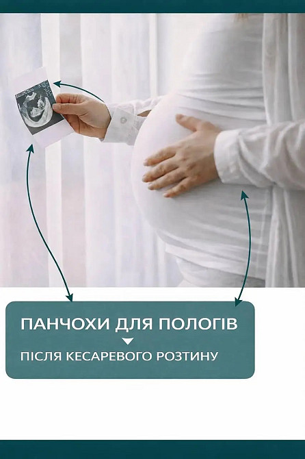 Компресійні панчохи на пологи антиемболічні розмір 3 (M) (13-18 мм.рт.ст.) Ortomedica білий Кривий Ріг - фото 3