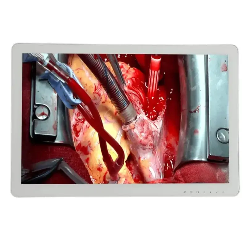 Медичний монітор для ендоскопії та хірургії S3281P 4K 31.5’’ Дніпро - фото 8