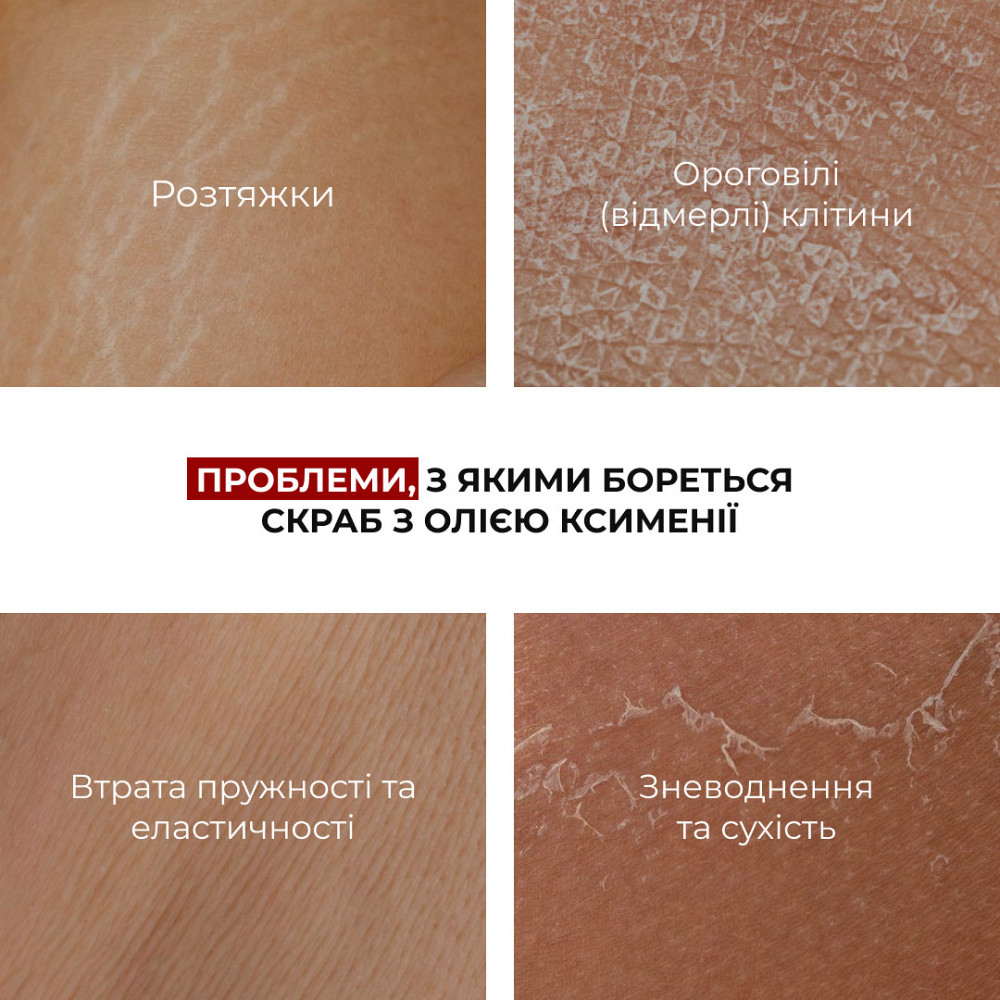 Cкраб с маслом ксимении для предупреждения появления растяжек Hillary Ximenia Radiance Body Scrub, 200 г Киев - изображение 8