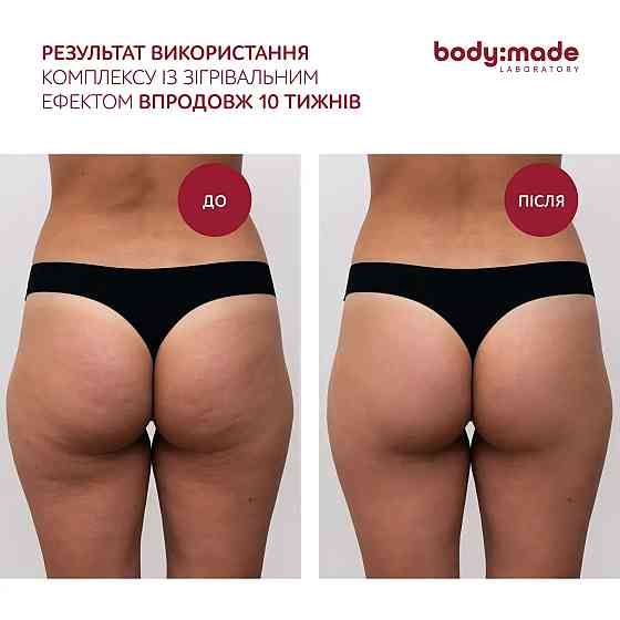 Бандажное обертывание с антицеллюлитным эффектом согревающее BodyMade 150 мл х 2 бинта Киев
