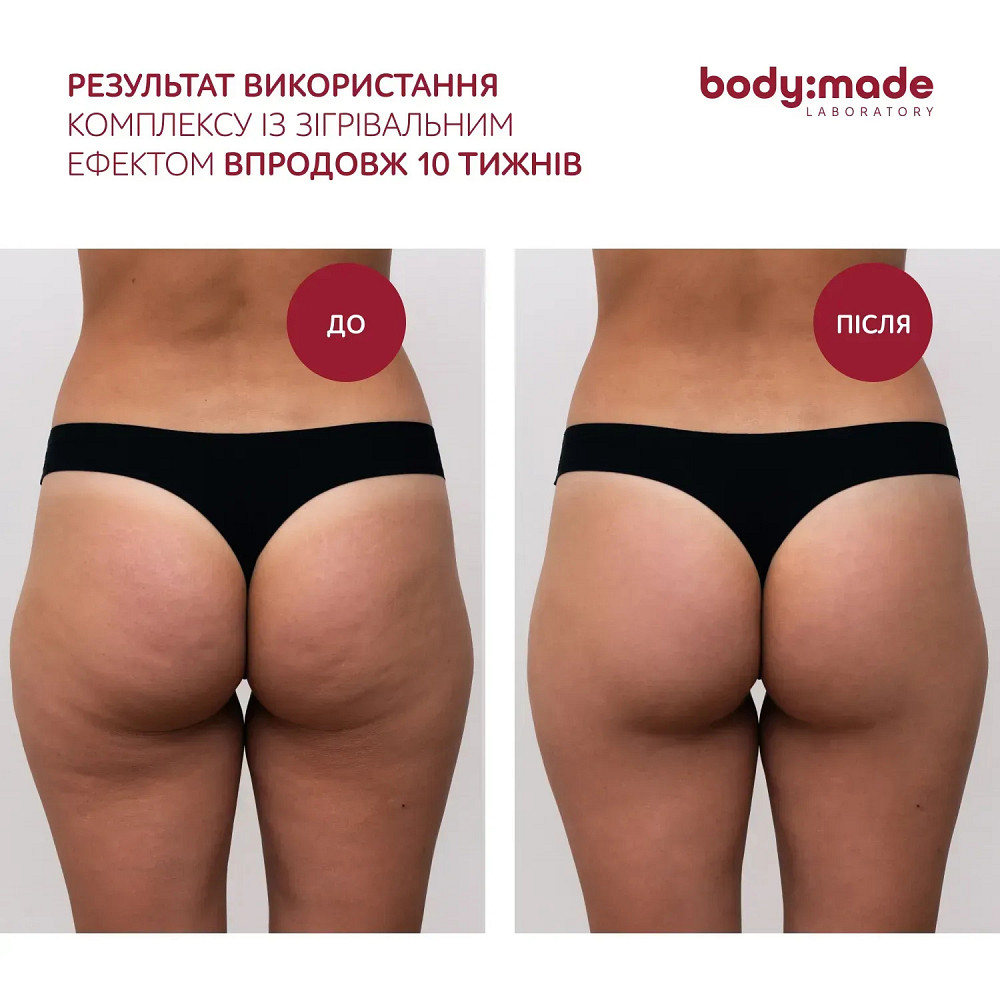 Бандажное обертывание с антицеллюлитным эффектом согревающее BodyMade 150 мл х 2 бинта Киев - изображение 6