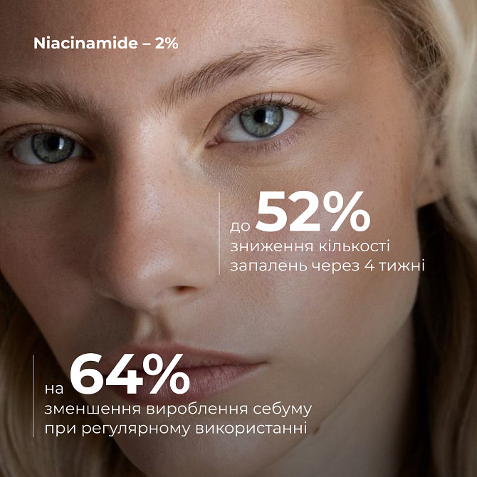 Комплексний б’юті-сет для жирної та комбінованої шкіри Perfect Niacinamide Sebo Balance Hillary Вінниця - фото 9