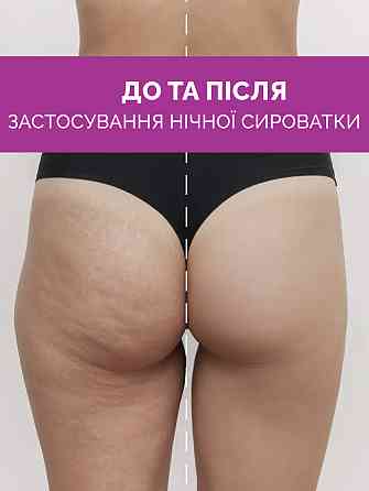 Суперконцентрированная антицеллюлитная ночная сыворотка для тела Reclaire cosmetics 200 мл Киев