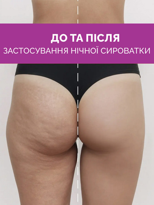 Суперконцентрированная антицеллюлитная ночная сыворотка для тела Reclaire cosmetics 200 мл Киев - изображение 3