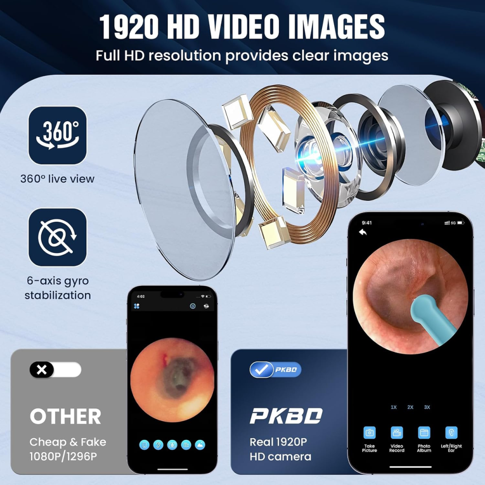 Отоскоп с камерой PKBD 1920P HD, 6 LED, Wi-Fi, Bluetooth 5.0, IP67, очиститель ушей для взрослых и детей, чёрный Киев - изображение 3