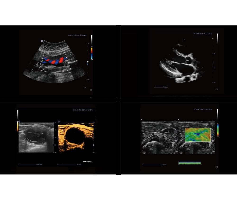 Ультразвукова діагностична система стаціонарна експертного класу +2 датчики Cetus 40 Focus & Fusion Дніпро - фото 4