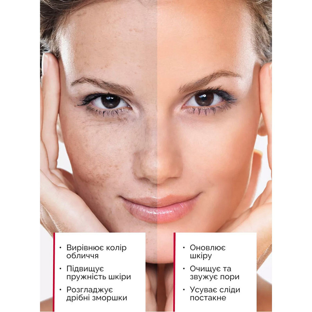 Кислотный пилинг для лица AHA 30%+BHA 1% Reclaire cosmetics 30 мл Киев - изображение 11