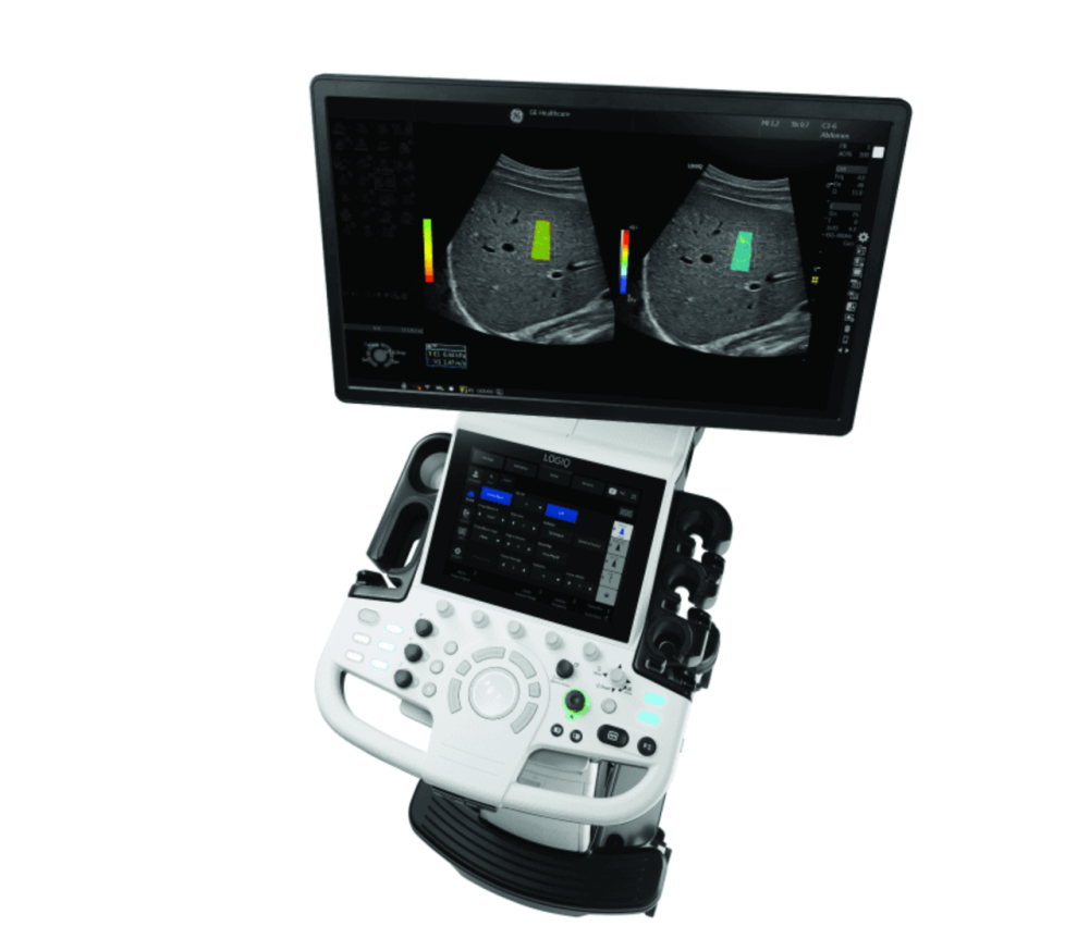Ультразвуковий апарат (УЗД) LOGIQ™ P9 XDсlear Дніпро - фото 4
