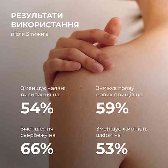 Очищувальний гель для тіла з саліциловою кислотою Anti-Acne Salicylic Body Wash Hillary 200 мл Вінниця