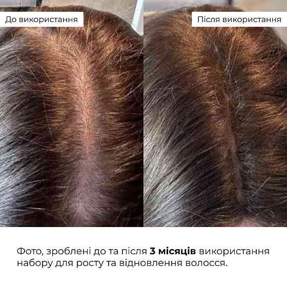 Кондиціонер для росту волосся Hillary Hop Cones & B5 Hair Growth Invigorating, 250 мл Київ