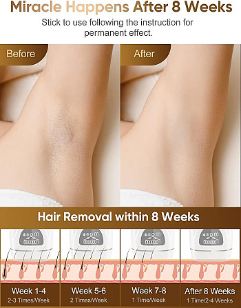 Эпилятор IPL Hair Removal DYM-022 с охлаждением, лазерная эпиляция, фотоэпиляция для тела, удаление  Киев - изображение 2