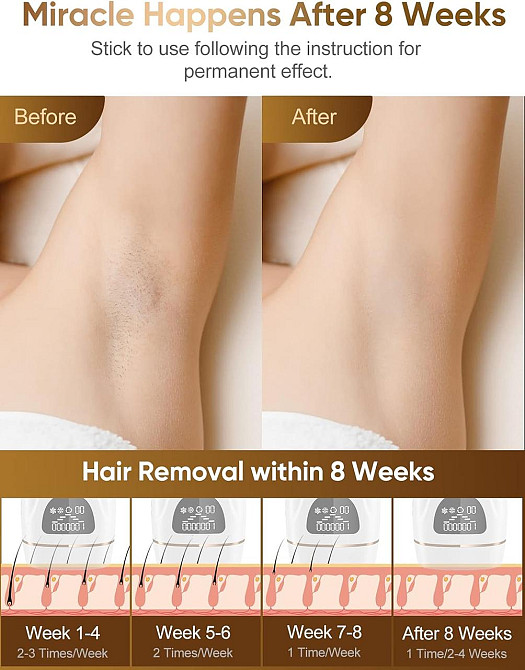 Эпилятор IPL Hair Removal DYM-022 с охлаждением, лазерная эпиляция, фотоэпиляция для тела, удаление волос Киев - изображение 2