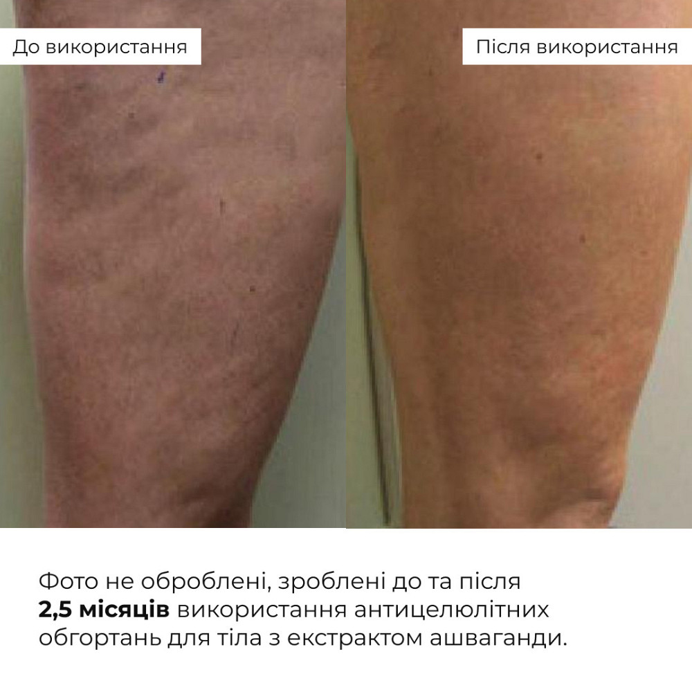 Курс антицелюлітних моделюючих обгортань з екстрактом ашваганди Hillary Ashwagandha Hot Slim (6 уп.) Київ - фото 4