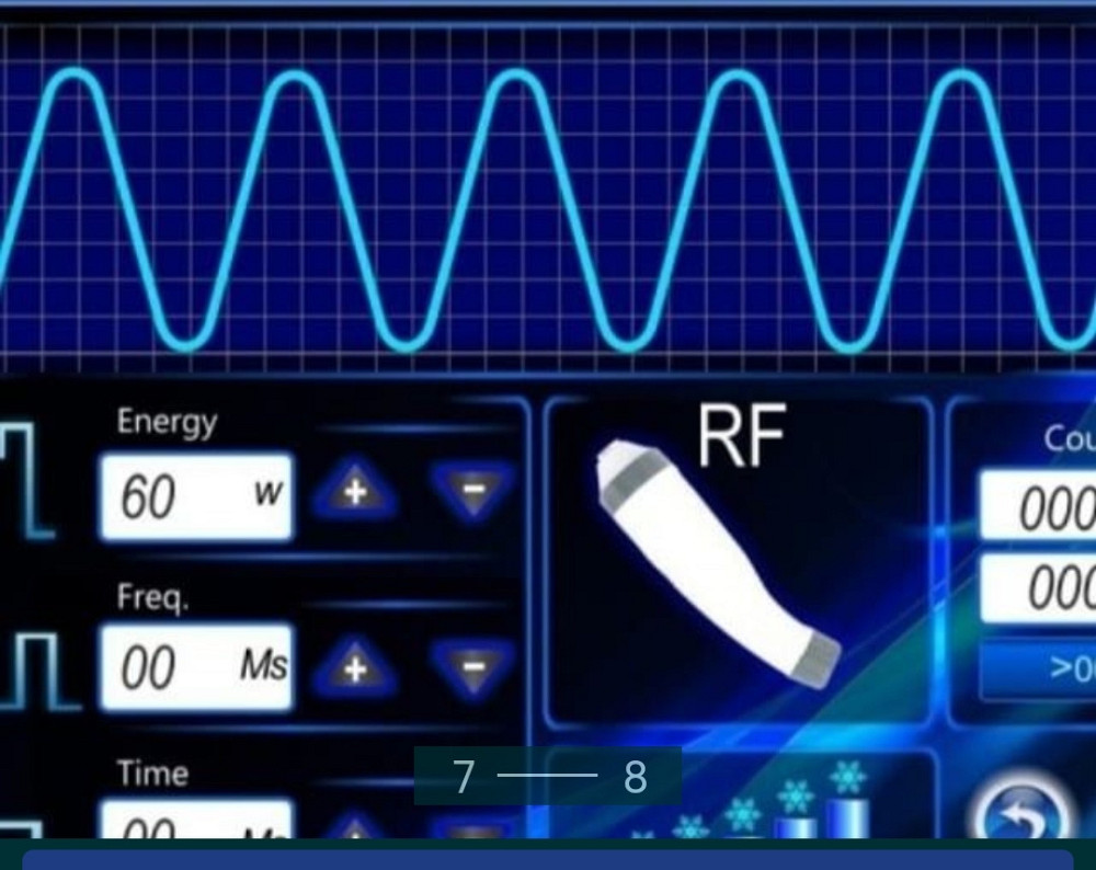 Аппарат Фотоэпиляции и фотоомоложения :IP-300. Киев - изображение 7