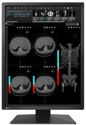 Монитор EIZO RadiForce MX217 Киев - изображение 1