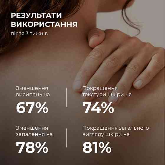Набор против воспалений и высыпаний на теле Hillary Back & Body Acne Care Set Киев