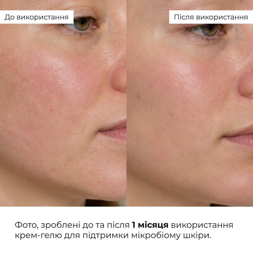 Набор для успокоения кожи и уменьшения признаков усталости вокруг глаз Hillary Soothing Skin & Tired Eye Care Set Киев - изображение 9
