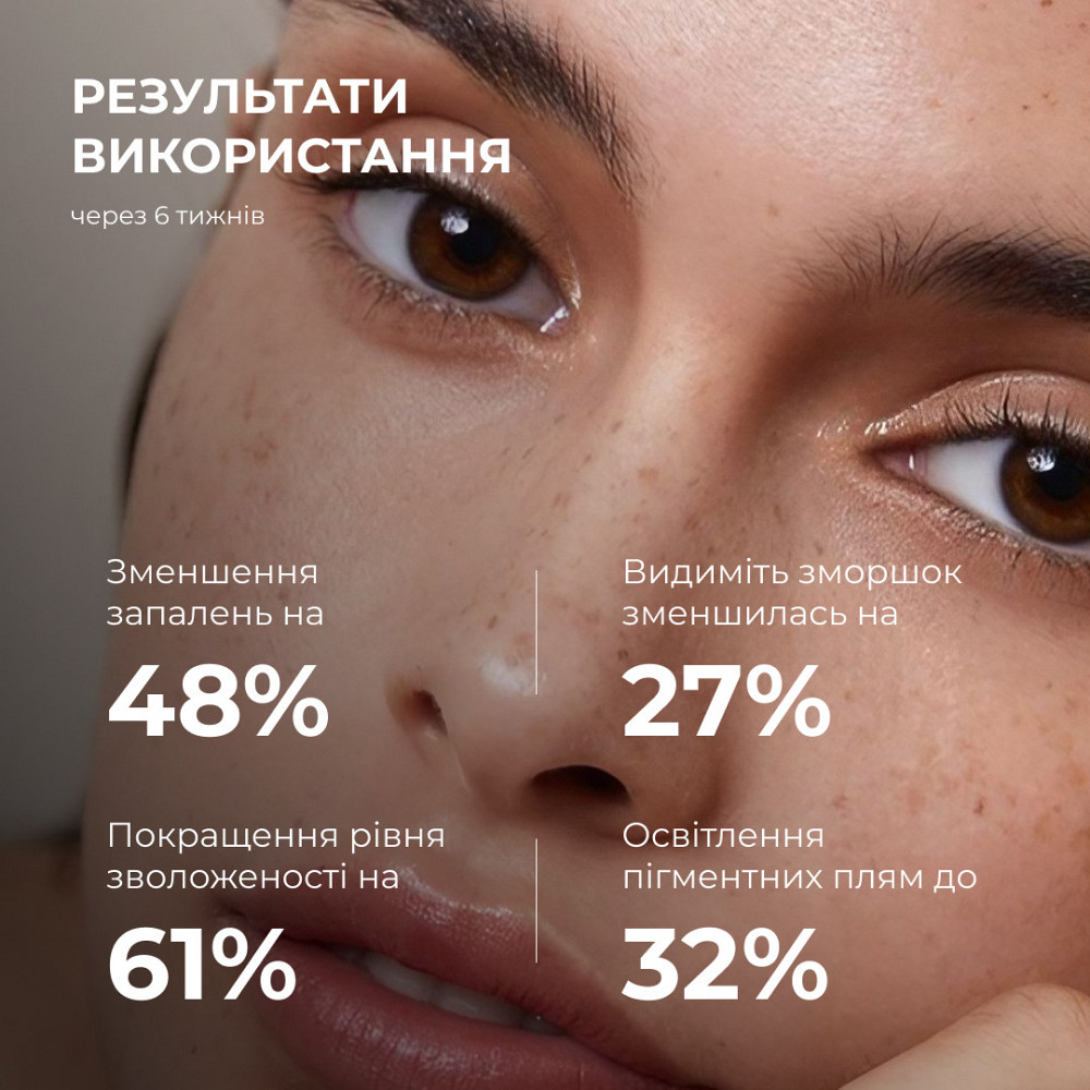 Набір для рівного тону та щоденного захисту SPF30+ Ivory HiLLARY Set for Even Skin Tone & Daily SPF30+ Киев - изображение 7